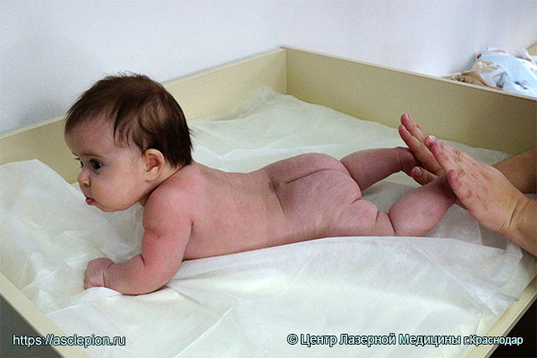 Упражнение при пупочной грыжи у новорожденных для укрепеления верхних мышц живота