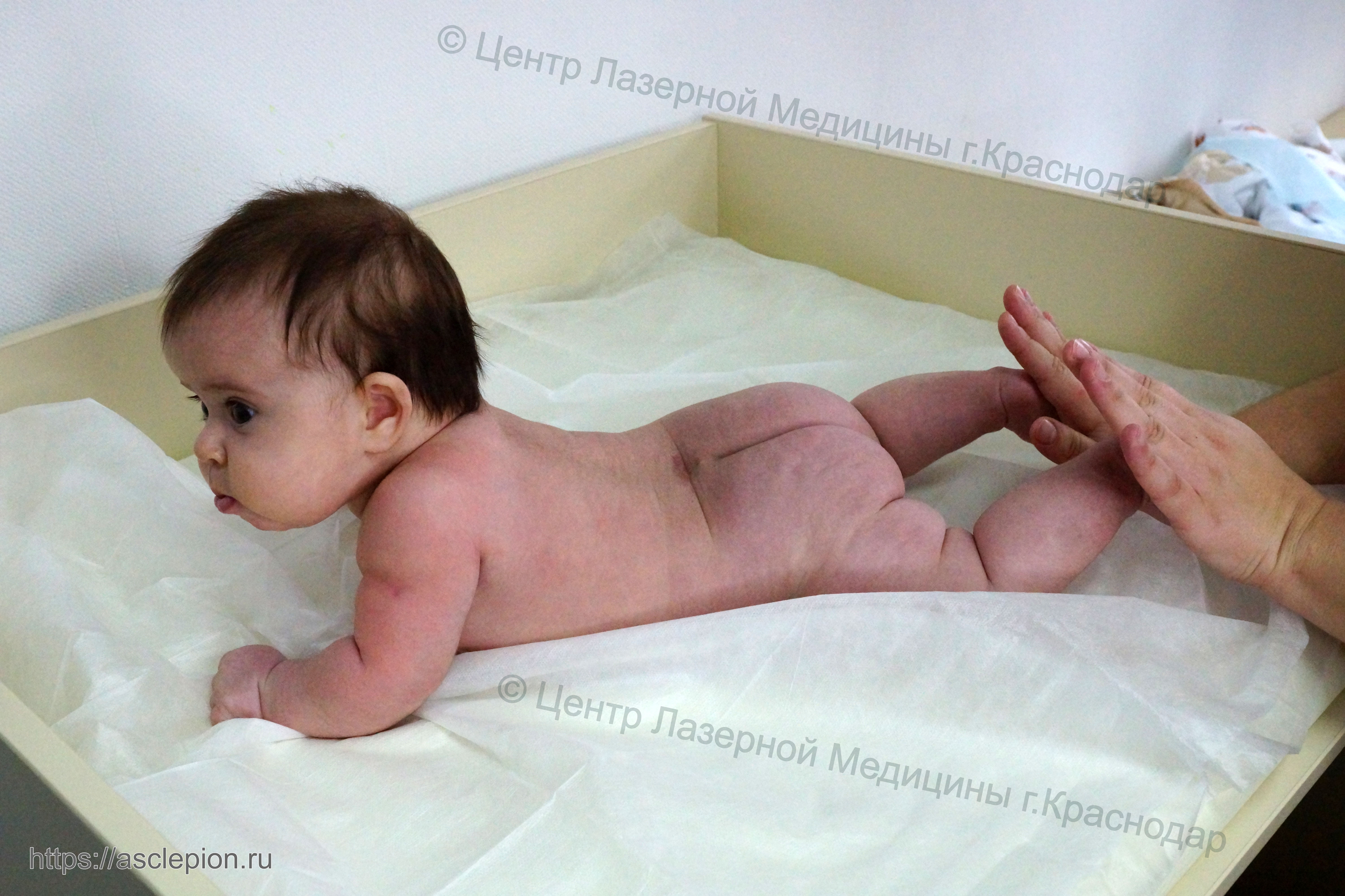 Упражнение новорожденной девочки для укрепеления боковых мышц живота при пупочной грыжи